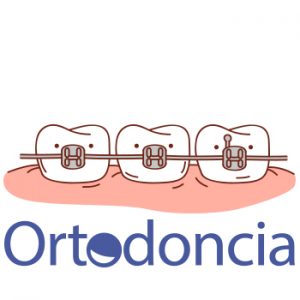 Ortodoncia - braquets