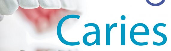 Caries Padecimiento y Causas