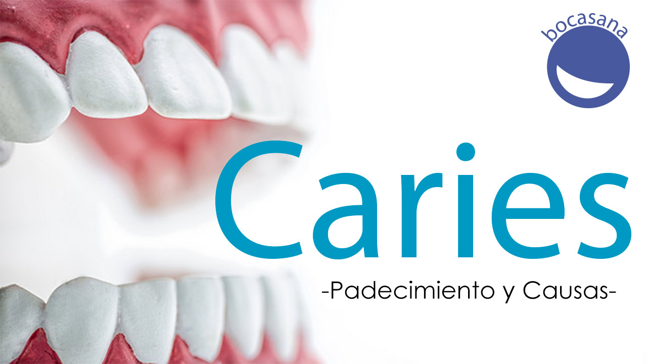 Caries Padecimiento y Causas