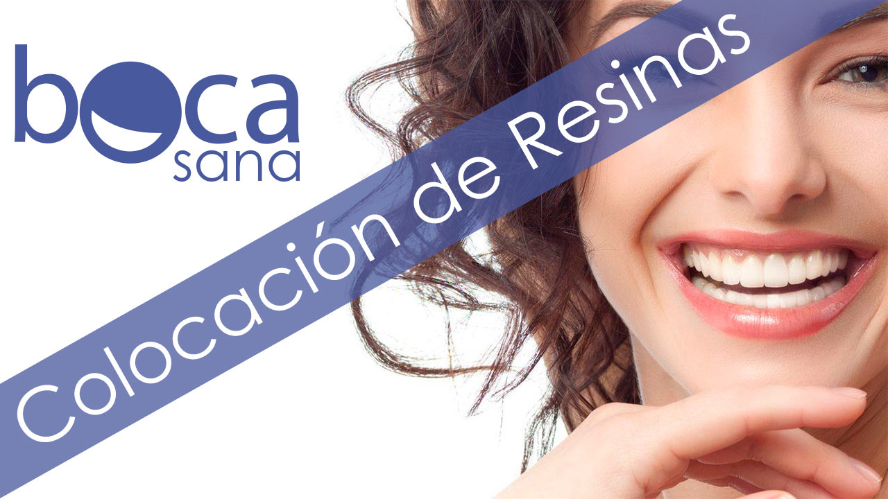 Colocacion de resinas