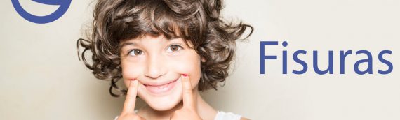 Fisura dental