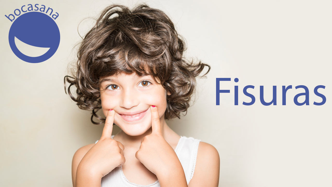 Fisura dental