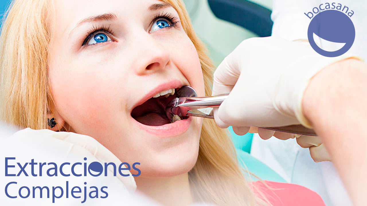 extracciones Complejas ¿que son?