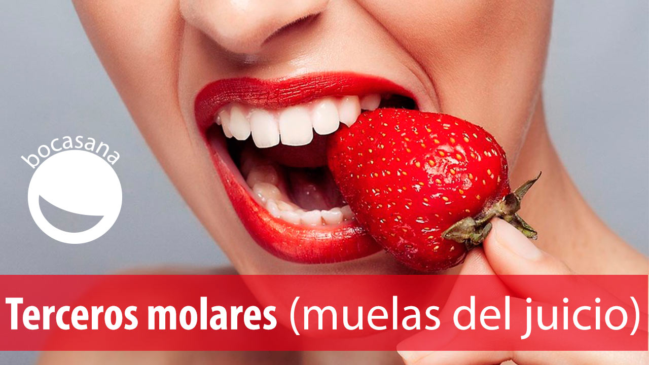Extracciones Muelas del Juicio Que son