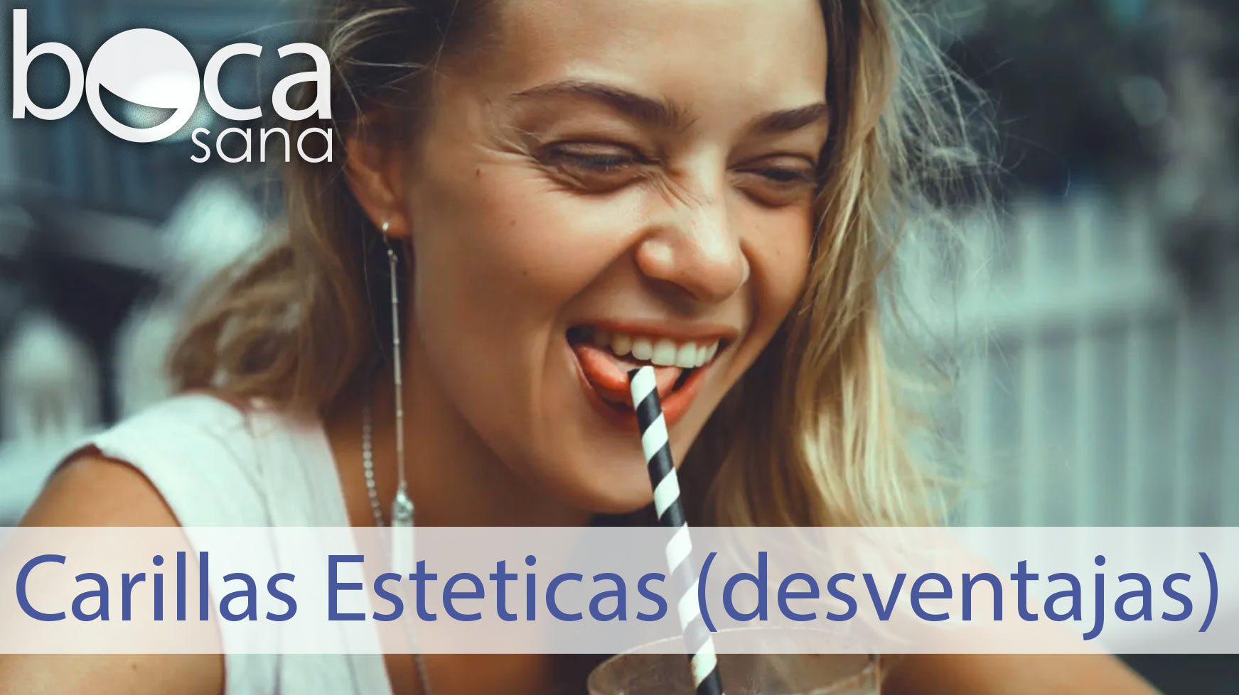 Carillas esteticas – desventaja
