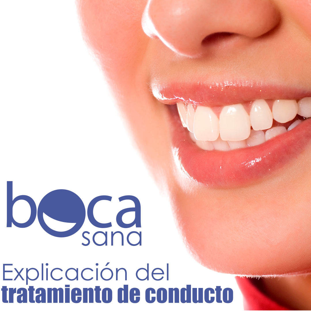 Explicación del tratamiento de conducto