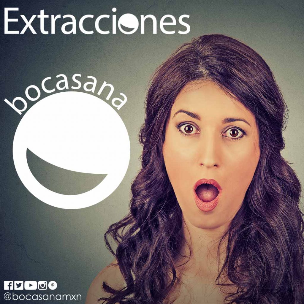 Consultorio Dental Extracciones
