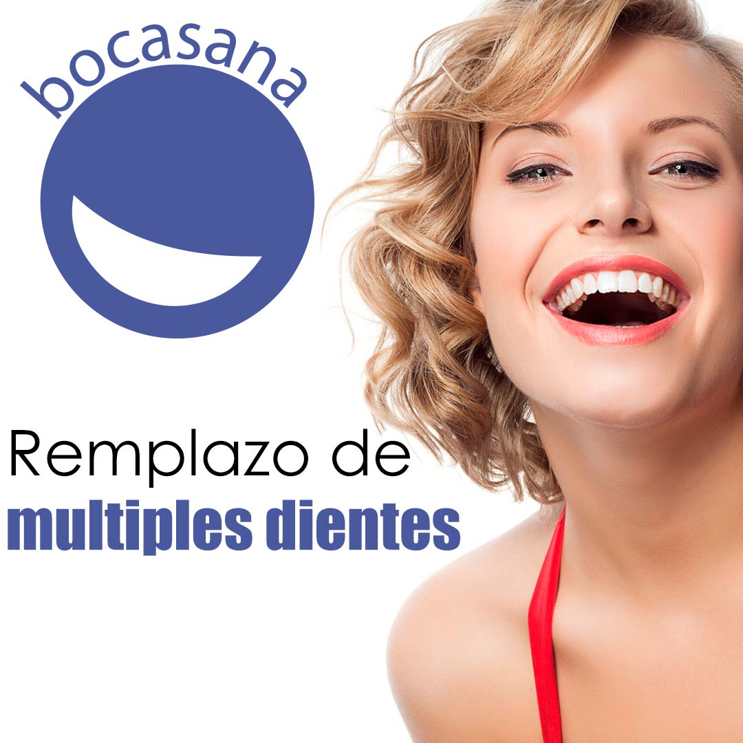 Remplazo de multiples dientes