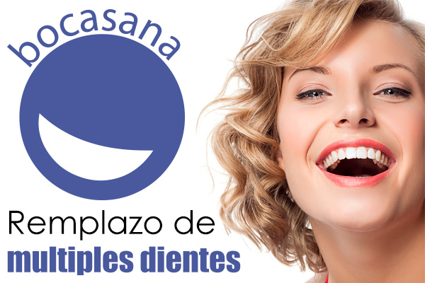 Remplazo de multiples dientes