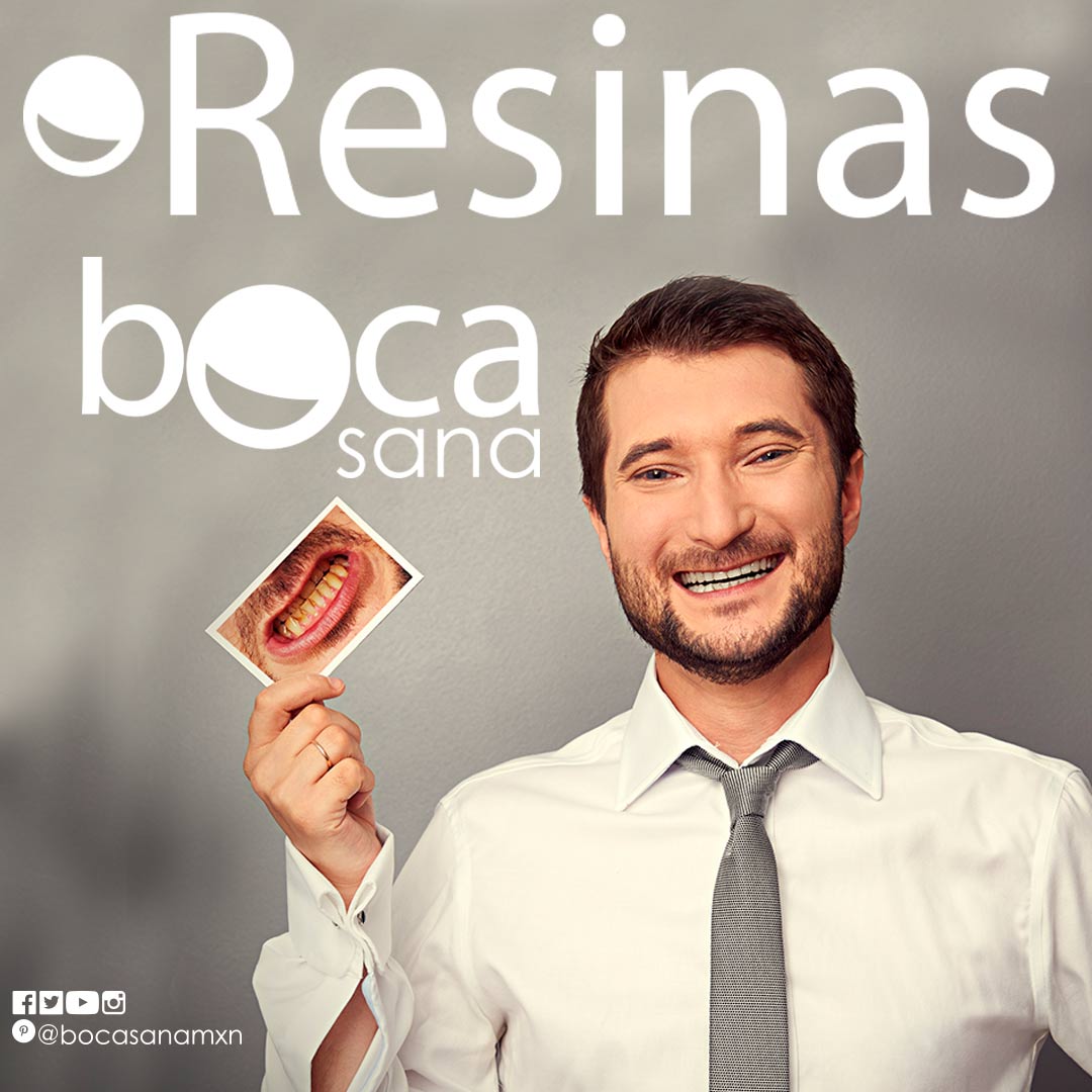 Aplicación de Resinas