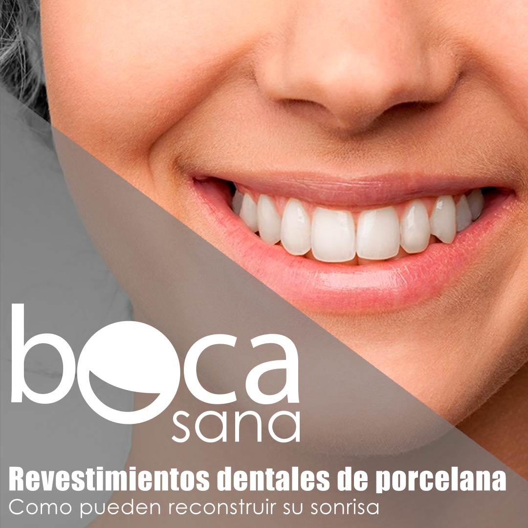 Como pueden reconstruir su sonrisa los revestimientos dentales de porcelana?