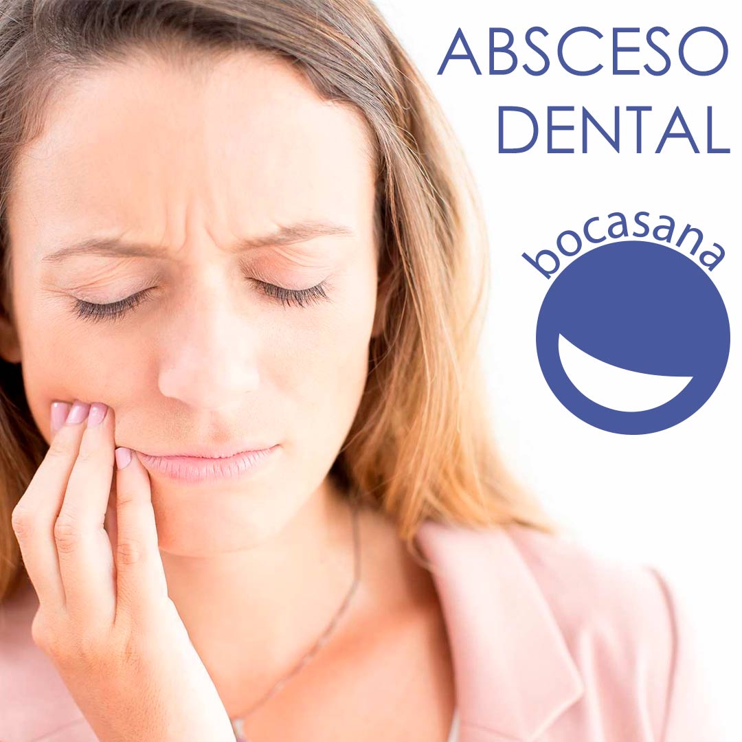 ABSCESO DENTAL