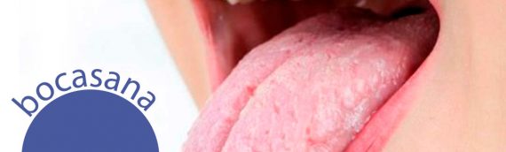 CAUSAS Y TRATAMIENTO DE LA BOCA SECA (XEROSTOMIA)