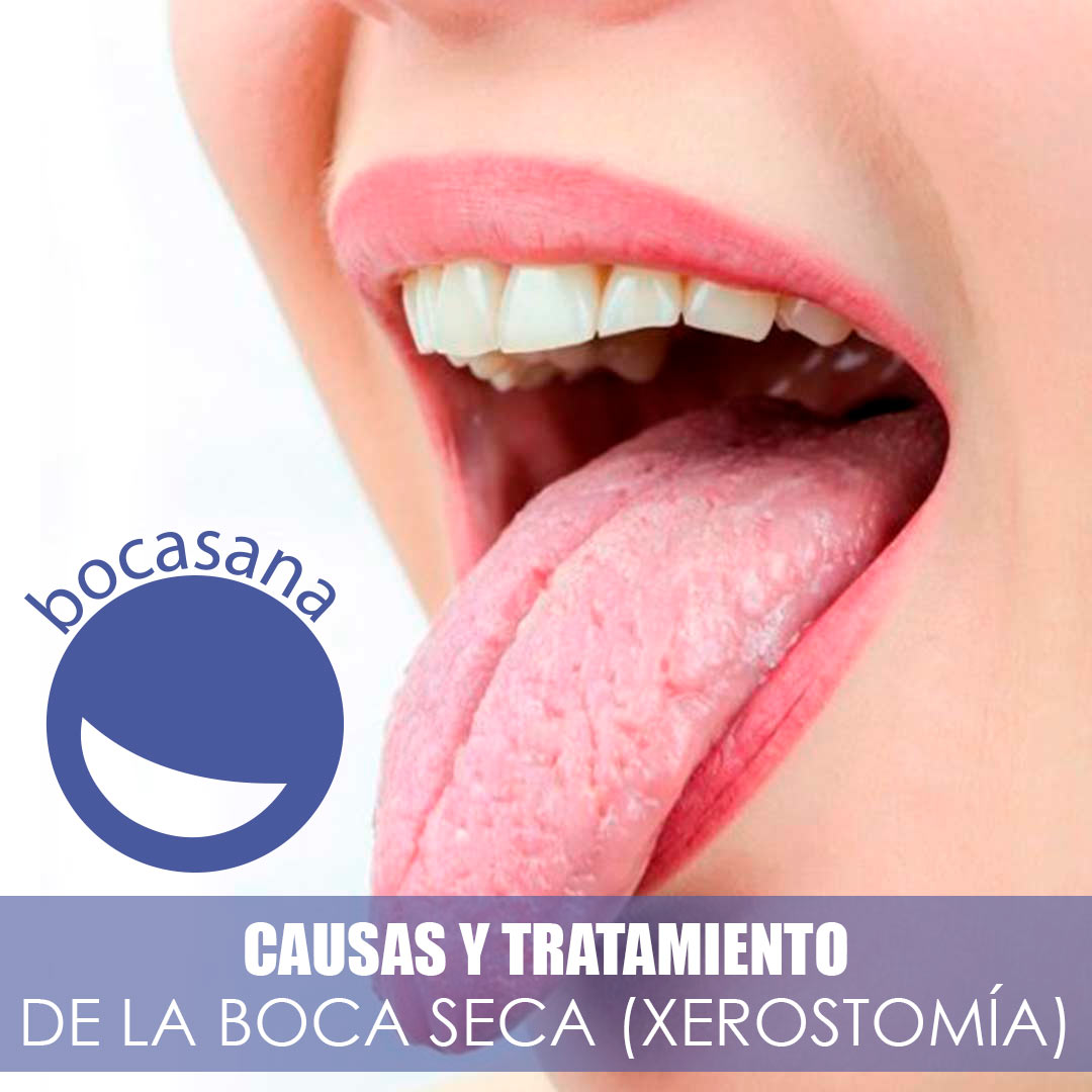 CAUSAS Y TRATAMIENTO DE LA BOCA SECA (XEROSTOMIA)
