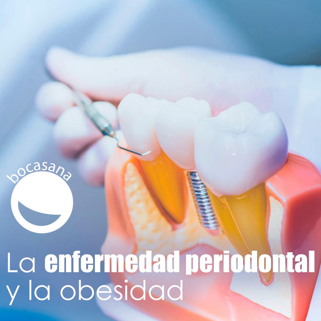 La Enfermedad Periodontal Y La Obesidad
