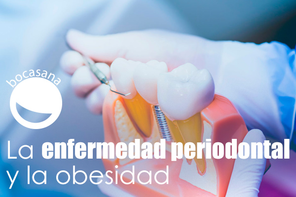 Enfermedad Periodontal