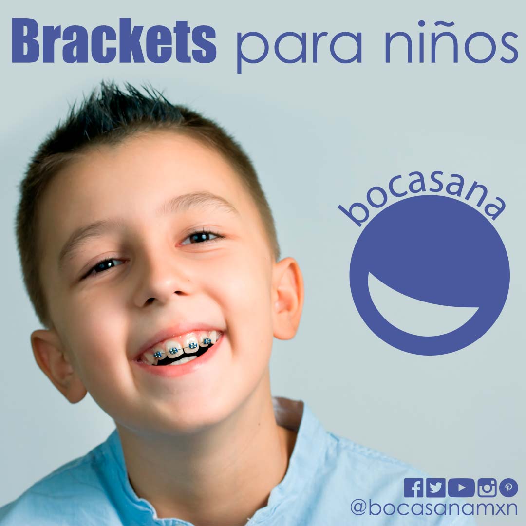 Brackets para niños