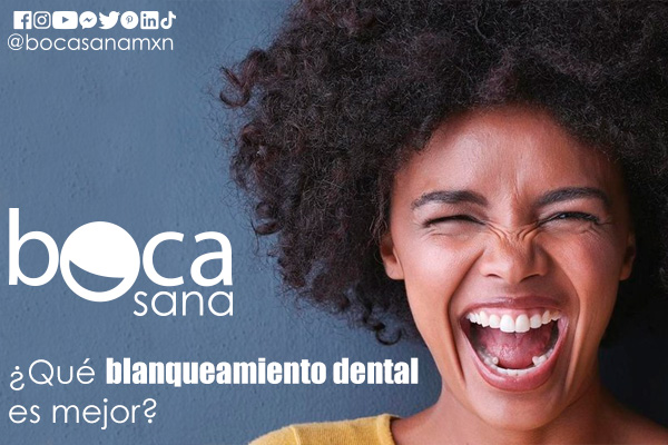 210825 BocaSana blanqueamineto dentall