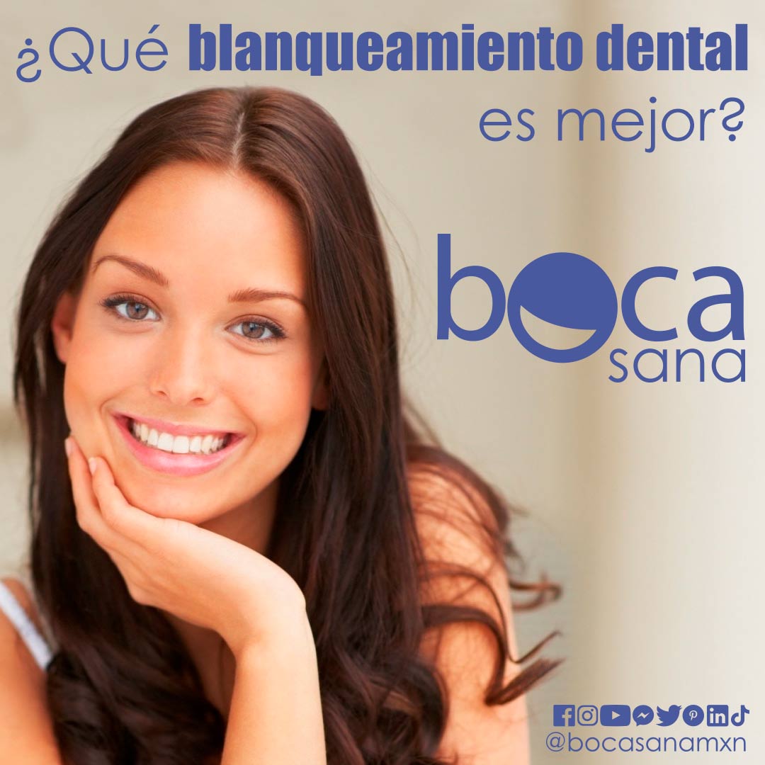 Que blanqueamiento dental es mejor?