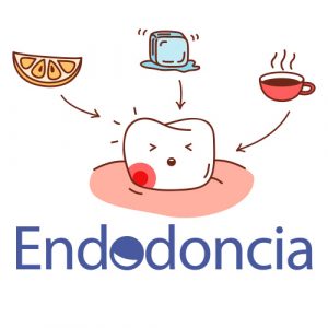 Endodoncias